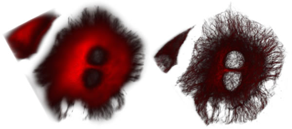 Left panel: Conventional wide-field image of dividing HEK cells where the tubulin network is labeled with fluorescent quantum dots. Right panel: Same cells in SOFI resolution – the tubulin network is visible in much higher resolution, contrast and finer detail.