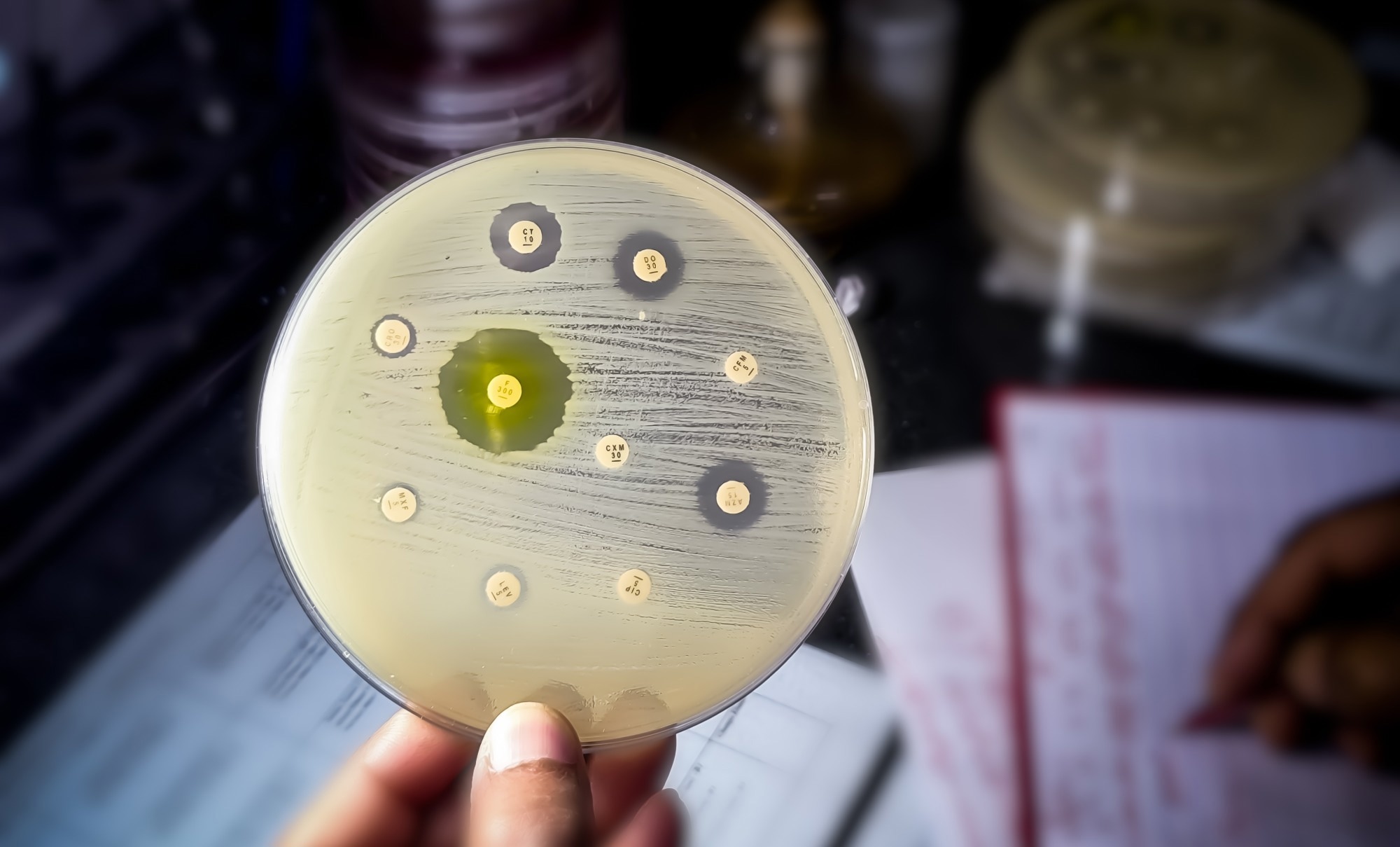 A picture of an antibiotic susceptibility test
