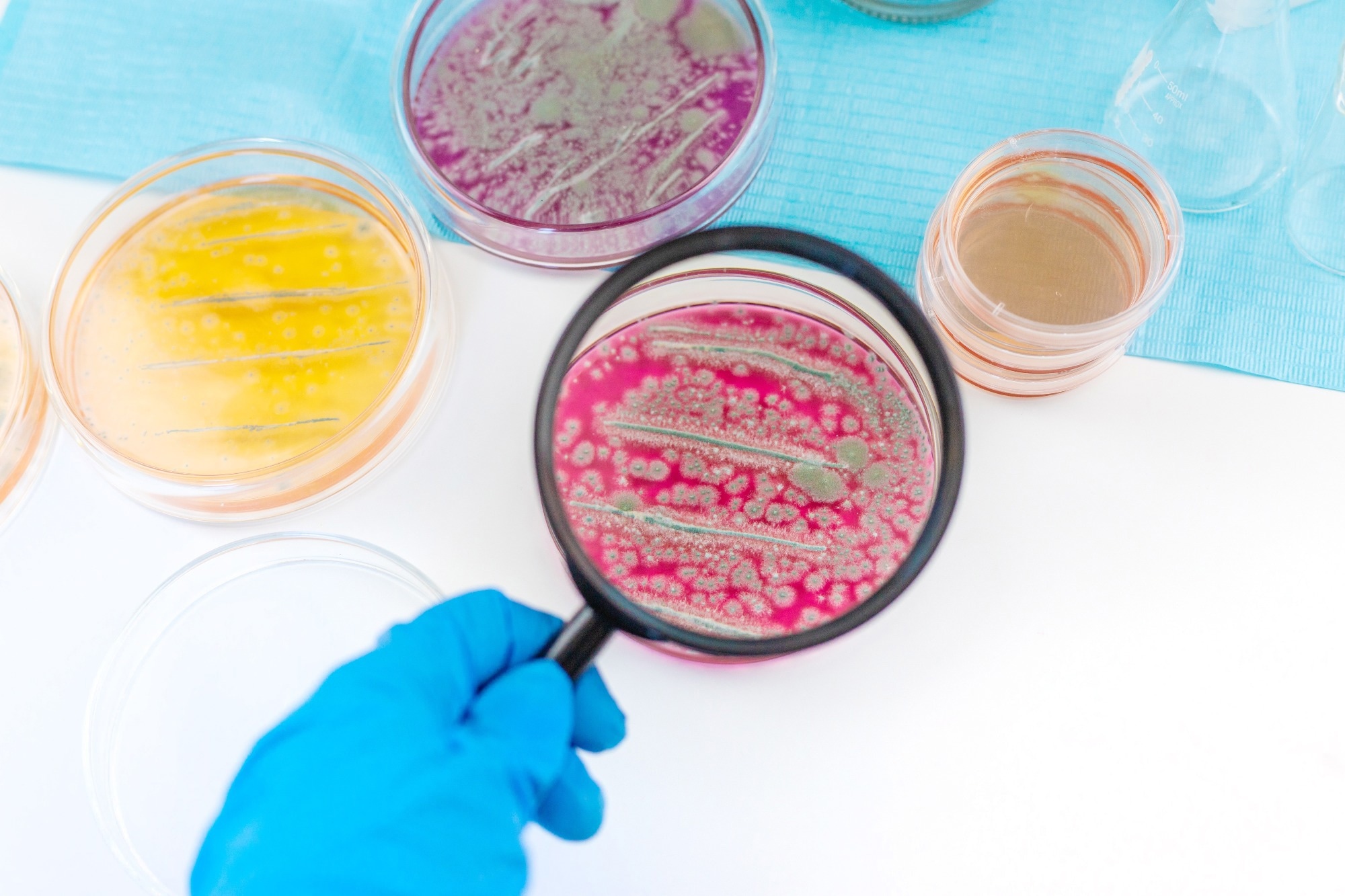 A picture of a microbial detection lab
