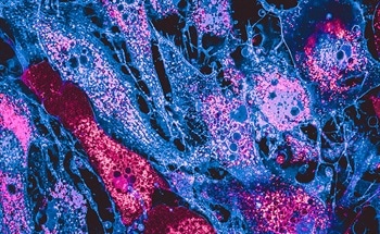 Using Quantum Computing to Enhance Cell Imaging