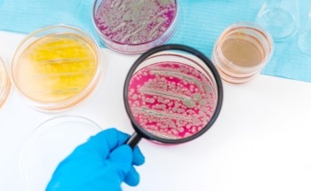 Quantum & Squeezed Light Techniques for Early Microbial Detection