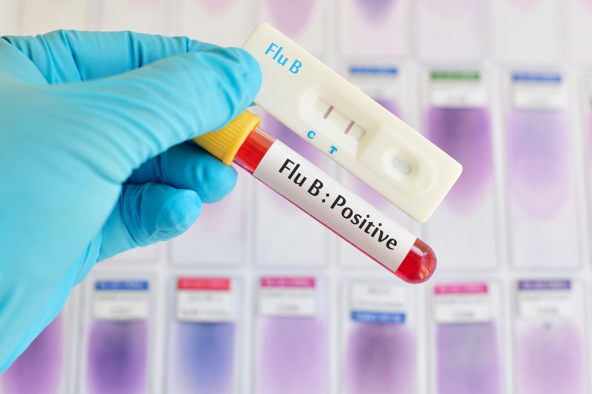 Influenza B Virus Detection with Quantum Dot-based Fluorescence Biosensors