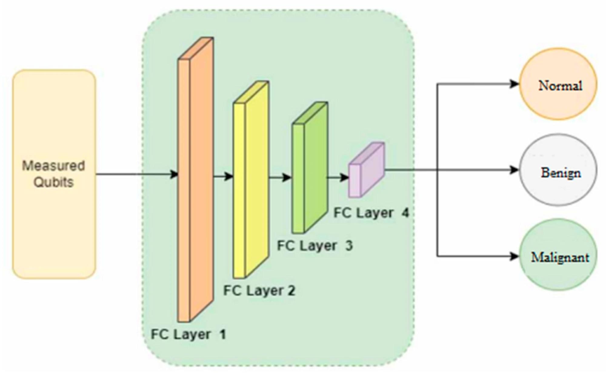 Quantum Hybrid Model Enhances Lung Cancer Detection