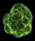 Debris and Stars' Cores Hurtle Off in Opposite Directions When Stellar Giants Die