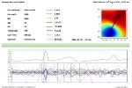 Quantum Vitalscan Enables Medical Professionals to Triage Patients Suffering from Chest Pains