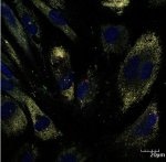 Quantum Dots Could be Used to Test Drug Delivery