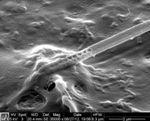 Researchers Insert Sophisticated Light Resonators inside Living Cells