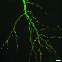 Quantum Dot Imaging Advances