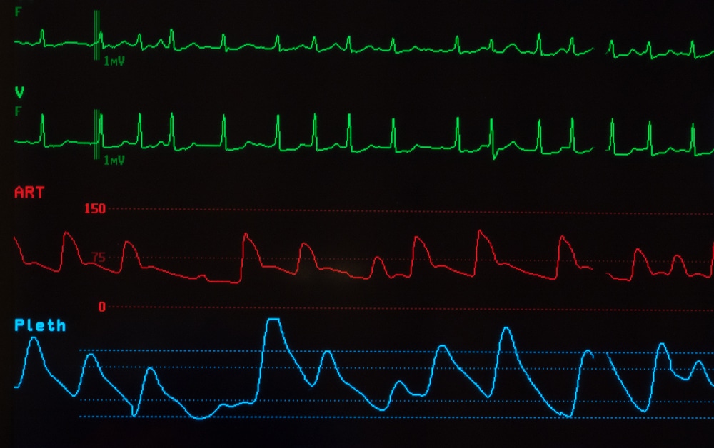 New Quantum Technology Could Help Diagnose And Treat Heart Condition