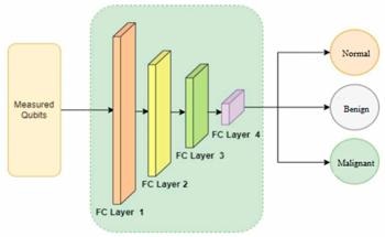 Quantum Hybrid Model Enhances Lung Cancer Detection