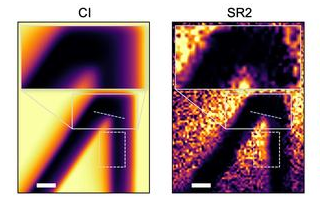 Novel Quantum Optical Setup Delivers Fourfold Resolution Boost in Microscopy