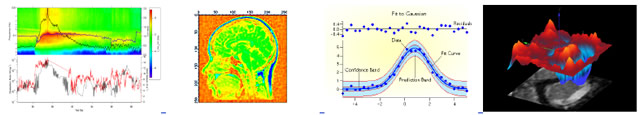 IGOR Pro 6: Scientific Graphing, Data Analysis, Image Processing Software